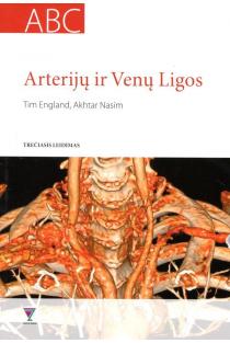 Arterijų ir venų ligos | Tim England, Akhtar Nasim