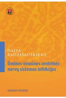 Ūminės virusinės centrinės nervų sistemos infekcijos | Daiva Radzišauskienė