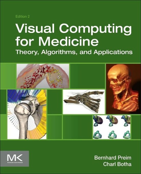 Visual Computing for Medicine: Theory, Algorithms, and Applications
