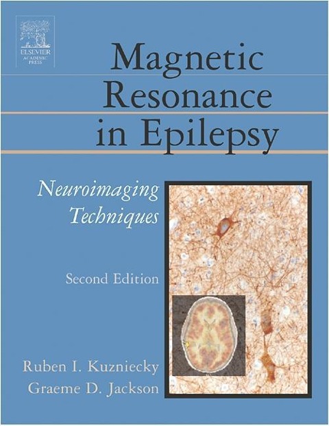 Magnetic Resonance in Epilepsy: Neuroimaging Techniques