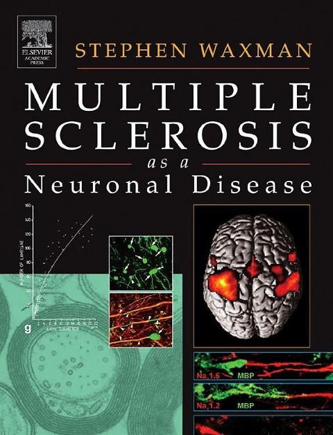 Multiple Sclerosis as a Neuronal Disease
