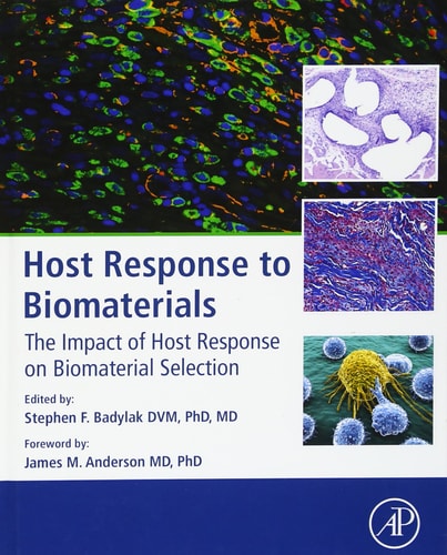 Host Response to Biomaterials The Impact of Host Response on Biomaterial Selection