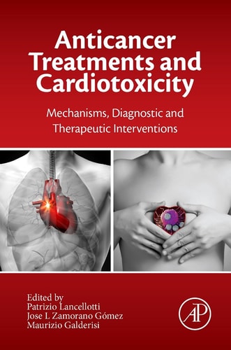 Anticancer Treatments and Cardiotoxicity Mechanisms, Diagnostic and Therapeutic Interventions