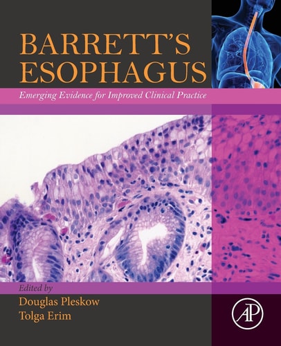 Barrett's Esophagus Emerging Evidence for Improved Clinical Practice