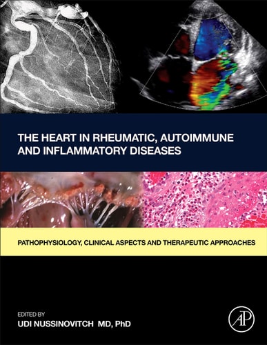 The Heart in Rheumatic, Autoimmune and Inflammatory Diseases Pathophysiology, Clinical Aspects and Therapeutic Approaches