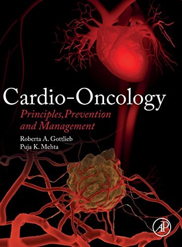 Cardio-Oncology Principles, Prevention and Management