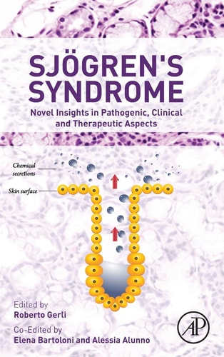 Sjogren's Syndrome Novel Insights in Pathogenic, Clinical and Therapeutic Aspects