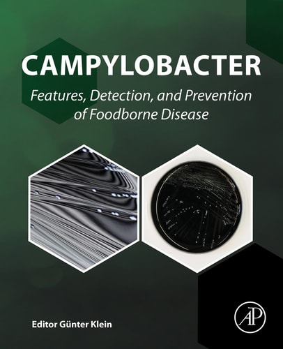 Campylobacter Features, Detection, and Prevention of Foodborne Disease