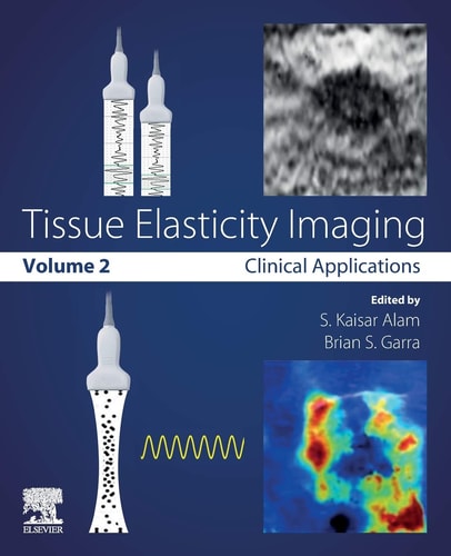 Tissue Elasticity Imaging Volume 2: Clinical Applications