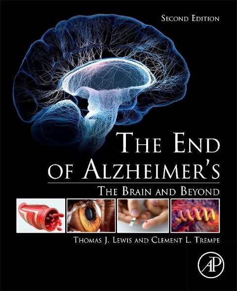 The End of Alzheimers: The Brain and Beyond