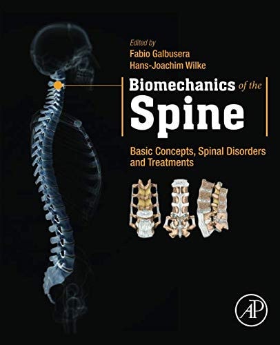 Biomechanics of the Spine Basic Concepts, Spinal Disorders and Treatments