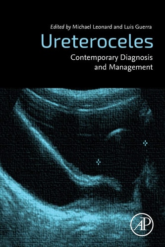 Ureteroceles Contemporary Diagnosis and Management
