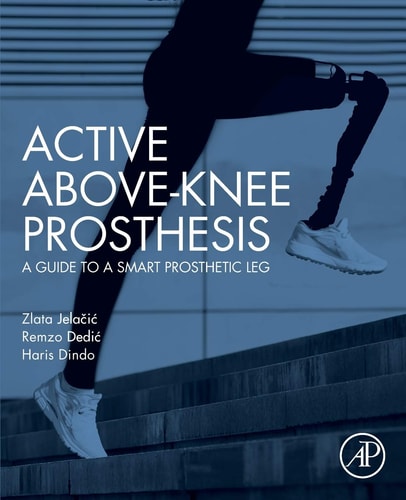 Active Above-Knee Prosthesis A Guide to a Smart Prosthetic Leg