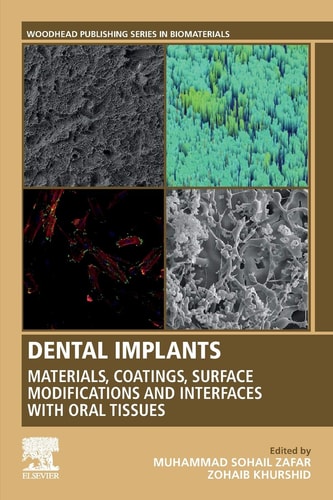 Dental Implants Materials, Coatings, Surface Modifications and Interfaces with Oral Tissues