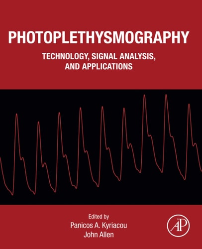 Photoplethysmography Technology, Signal Analysis and Applications