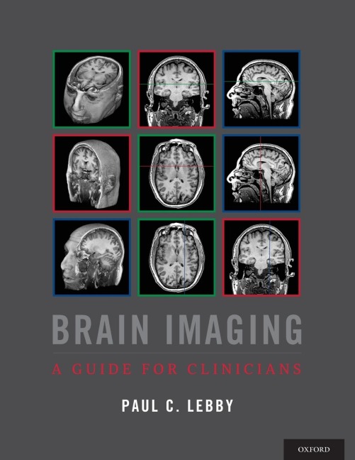Brain Imaging: A Guide for Clinicians