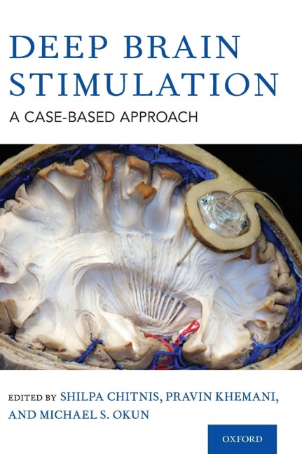 Deep Brain Stimulation: A Case-Based Approach