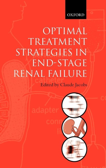 Optimal Treatment Strategies for End Stage Renal Failure