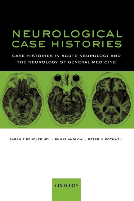 Neurological Case Histories: Case Histories in Acute Neurology and the Neurology of General Medicine
