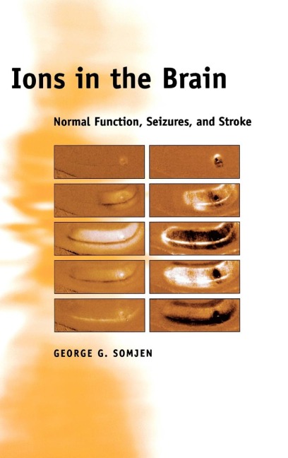 Ions in the Brain: Normal Function, Seizures, and Stroke