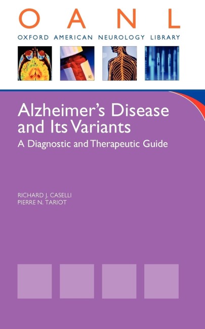 Alzheimers Disease and Other Dementias: A Clinicians Guide to Diagnosis and Management