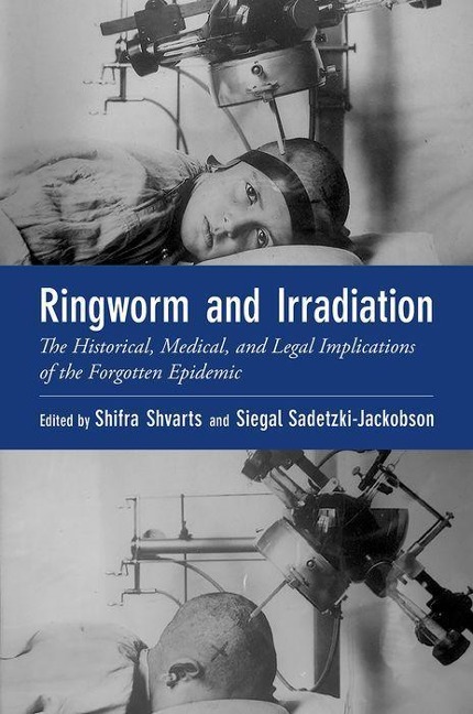 Ringworm and Irradiation: The Historical, Medical, and Legal Implications of the Forgotten Epidemic