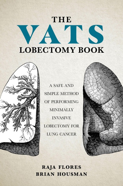 The Vats Lobectomy Book: A Safe and Simple Method of Performing Minimally Invasive Lobectomy for Lung Cancer