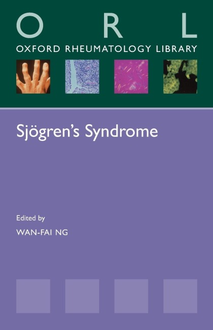 Sjogrens Syndrome