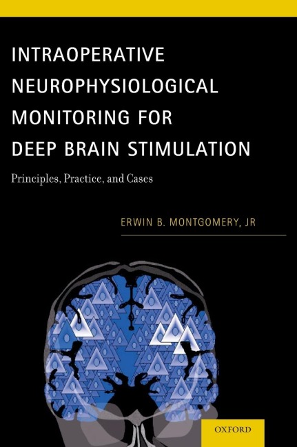 Intraoperative Neurophysiological Monitoring for Deep Brain Stimulation: Principles, Practice, and Cases