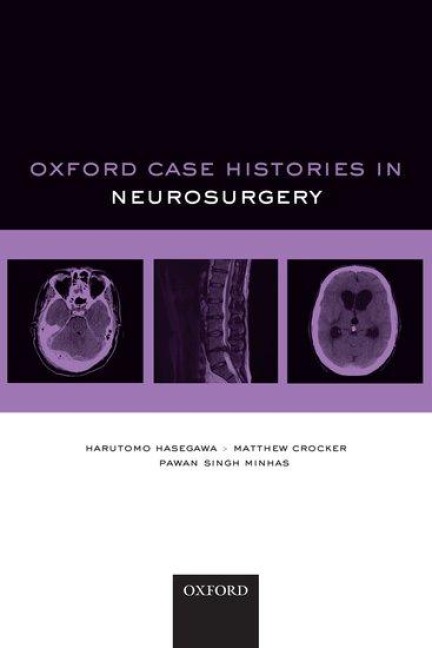 Oxford Case Histories in Neurosurgery