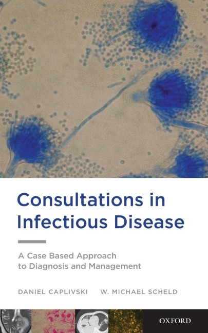 Consultations in Infectious Disease: A Case Based Approach to Diagnosis and Management