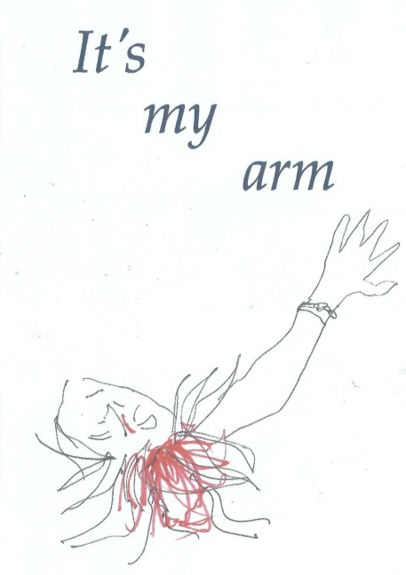 Its my arm