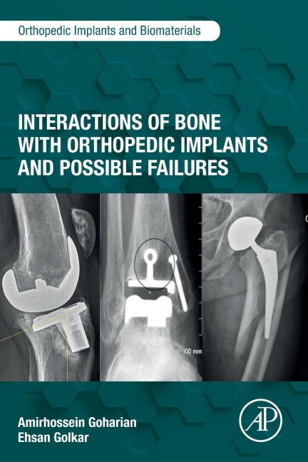 Interactions of Bone with Orthopedic Implants and Possible Failures