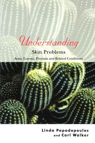 Understanding Skin Problems Acne, Eczema, Psoriasis and Related Conditions