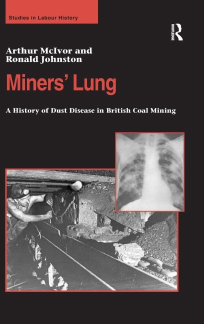Miners Lung: A History of Dust Disease in British Coal Mining