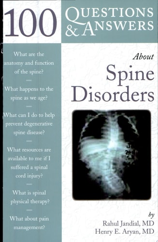 100 Questions & Answers About Spine Disorders