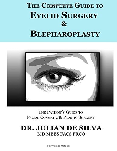 The Complete Guide to Eyelid Surgery & Blepharoplasty