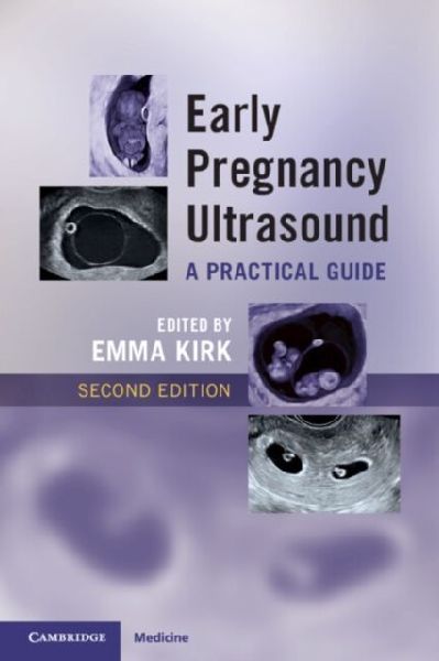 Early Pregnancy Ultrasound: A Practical Guide