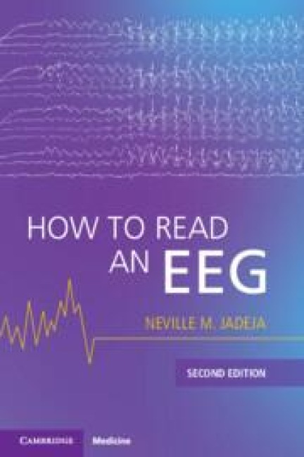 How to Read an EEG