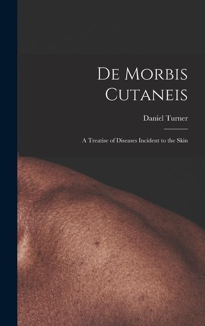 De Morbis Cutaneis: a Treatise of Diseases Incident to the Skin