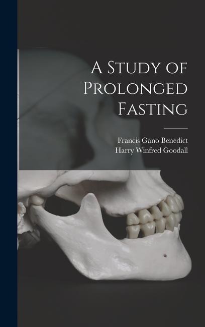 A Study of Prolonged Fasting