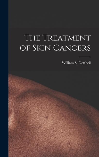 The Treatment of Skin Cancers