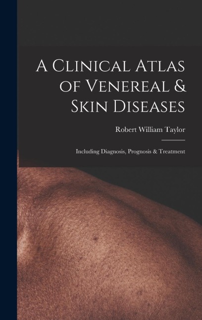 A Clinical Atlas of Venereal & Skin Diseases: Including Diagnosis, Prognosis & Treatment