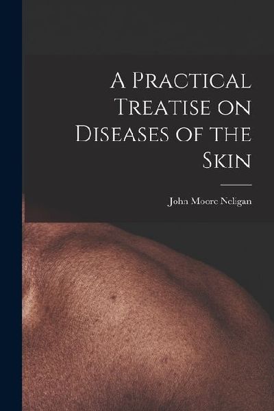 A Practical Treatise on Diseases of the Skin