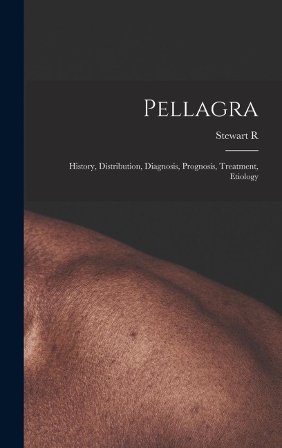 Pellagra: History, Distribution, Diagnosis, Prognosis, Treatment, Etiology