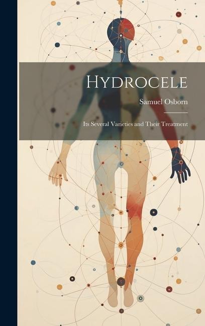 Hydrocele: Its Several Varieties and Their Treatment