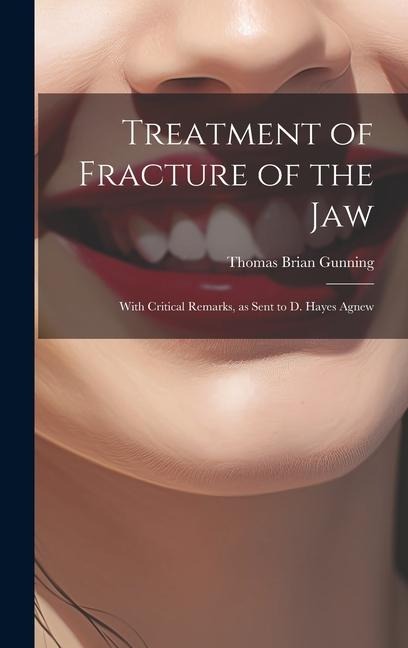 Treatment of Fracture of the Jaw; With Critical Remarks, as Sent to D. Hayes Agnew