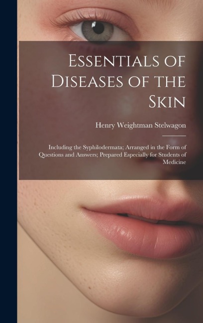 Essentials of Diseases of the Skin: Including the Syphilodermata; Arranged in the Form of Questions and Answers; Prepared Especially for Students of M