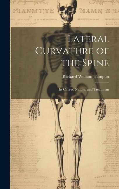 Lateral Curvature of the Spine: Its Causes, Nature, and Treatment