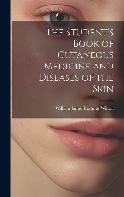 The Student's Book of Cutaneous Medicine and Diseases of the Skin